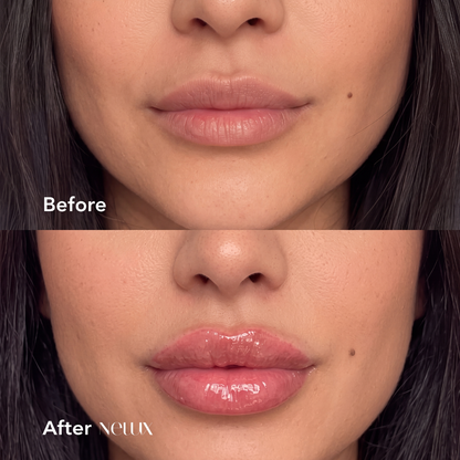 Hyaluronic Acid Lip Plumper